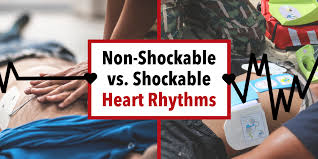 Understanding Shockable Vs Non Shockable Heart Rhythms